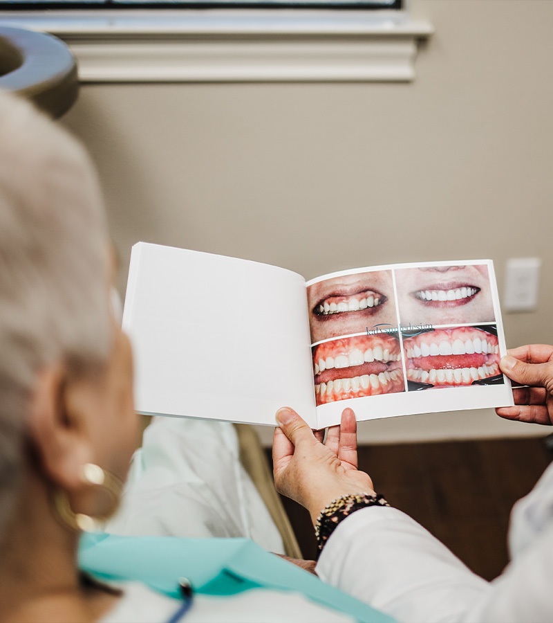 Katy Smile Design | Preventative Program, Periodontal Treatment and Crowns amp Caps